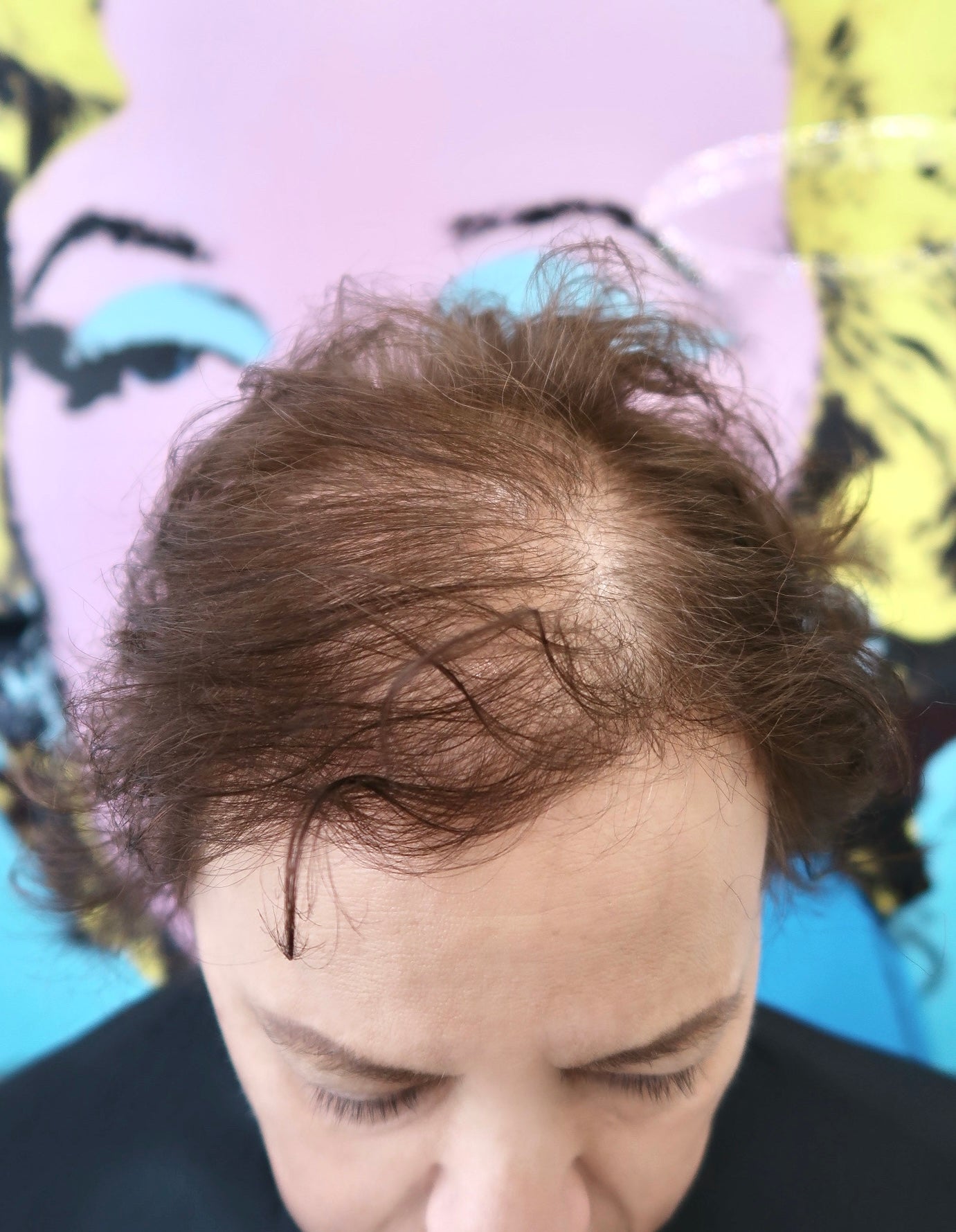 Human Hair Topper 6x6 Inch